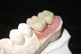 fu004