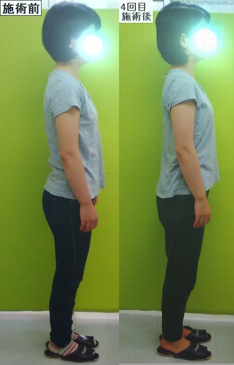 猫背矯正でスッキリして 蒸し暑い季節を気持ちよく過ごしませんか 津山市の姿勢矯正整体院 岡山県津山市の姿勢矯正 産後骨盤矯正 小顔 リンパケアの整体院 作楽 さくら 整体院 公式ブログ トップモデルも手掛けるトオールインワン整体施術 ブライダルエステ