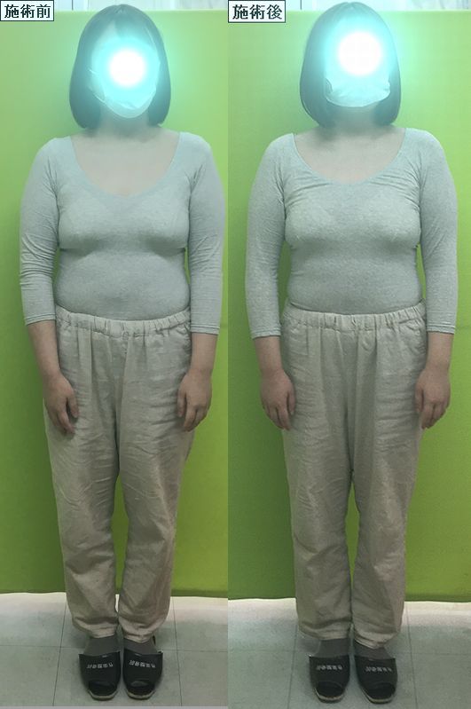 寒波の冷え込みで ガクッと猫背になったり 骨盤や背骨がグニャっと歪んでませんか 津山市の作楽整体院の姿勢矯正で スッキリスタイル取り戻してくださいね 岡山県津山市の姿勢矯正 産後骨盤矯正 小顔 リンパケアの整体院 作楽 さくら 整体院 公式ブログ 寒波の冷え込みで ガクッと猫背になったり 骨盤や背骨がグニャっと歪んでませんか 津山市の作楽整体院の姿勢矯正で スッキリスタイル取り戻してくださいね 岡山県津山市の姿勢矯正 産後骨盤矯正 小顔 リンパケアの整体院 作楽 さくら 整体院 公式ブログ