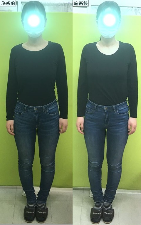 反り腰 産後骨盤矯正 猫背 小顔 作楽 さくら 整体院 公式ブログ 岡山県津山市