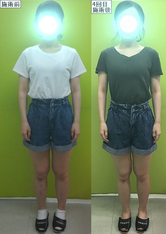 足首のゆがみや反り腰を矯正してからゴールデンウィークのお出かけしませんか 津山市の姿勢改善整体院 岡山県津山市の姿勢矯正 産後骨盤矯正 小顔 リンパケアの整体院 作楽 さくら 整体院 公式ブログ トップモデルも手掛けるトオールインワン整体施術