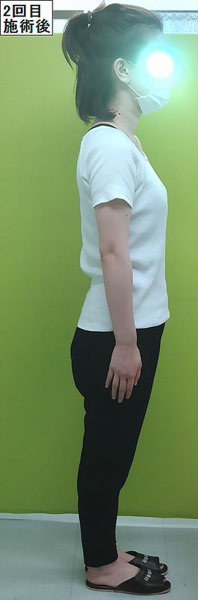 KIMG8554a