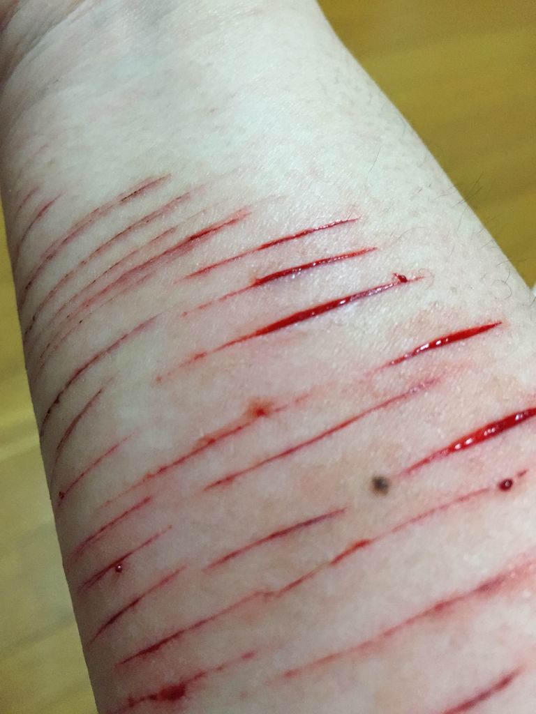 ダメな子 あたしの居場所 リストカット時どき写真