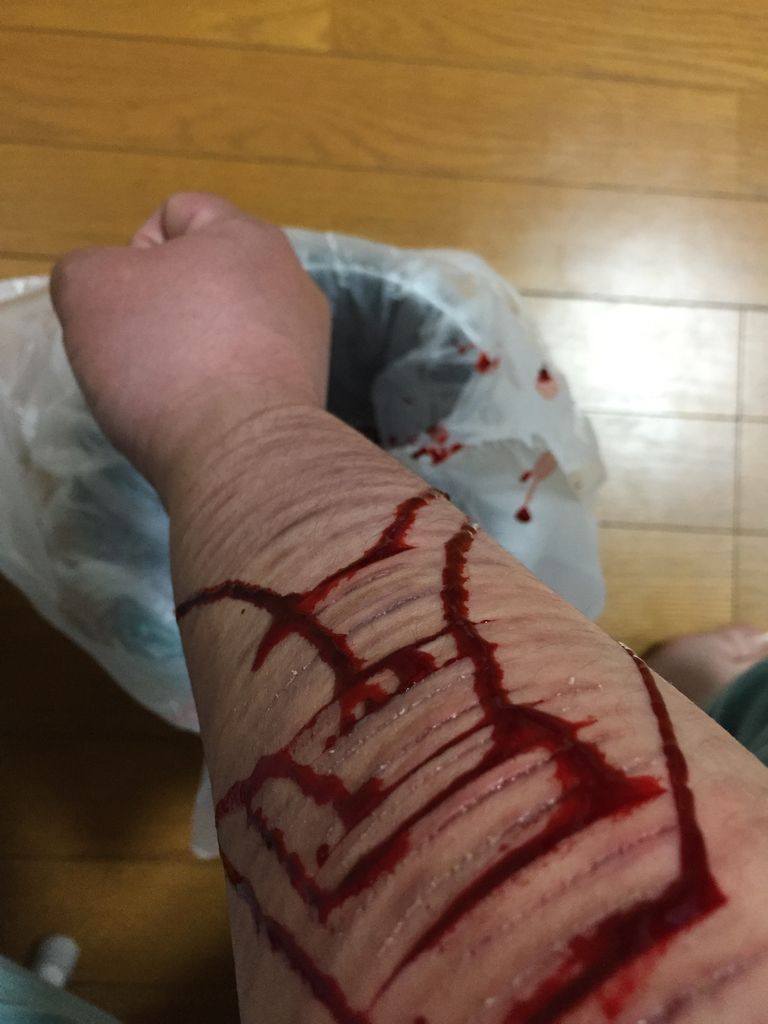過去と現在 あたしの居場所 リストカット時どき写真