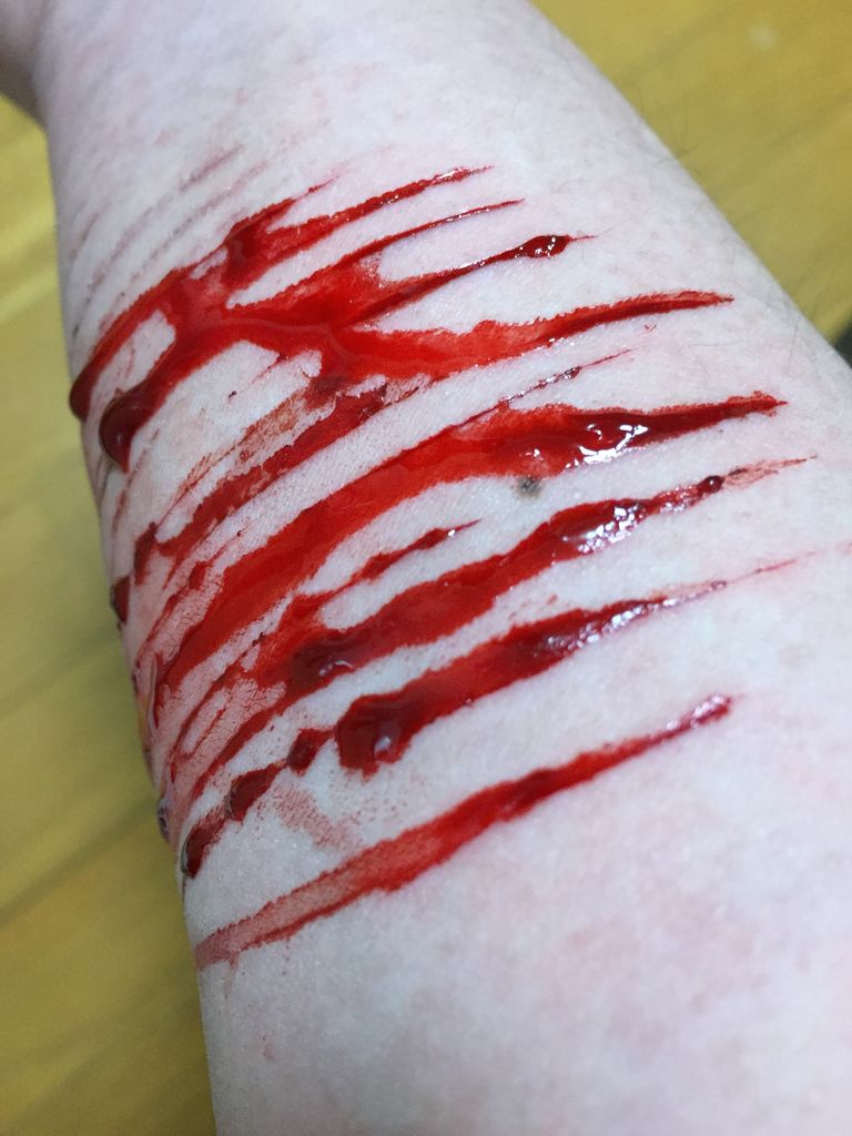 ダメな子 あたしの居場所 リストカット時どき写真