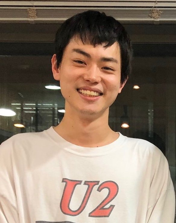悲報 菅田将暉さんの生え際 注目 芸能情報 悲報 菅田将暉さんの生え際 注目 芸能情報