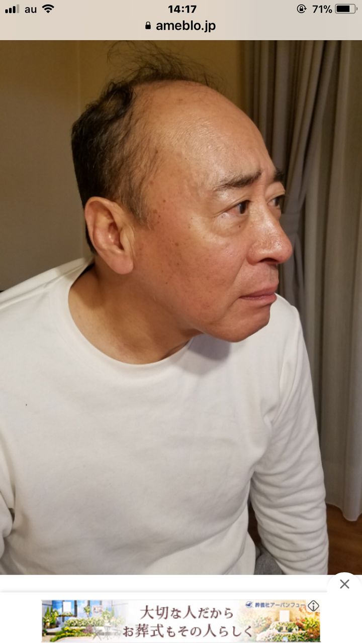 さすが 有吉弘行 モト冬樹が何気にハゲが進行したことを見抜く ちょっとした時間に読める芸能ニュース さすが 有吉弘行 モト冬樹が何気にハゲが進行したことを見抜く ちょっとした時間に読める芸能ニュース