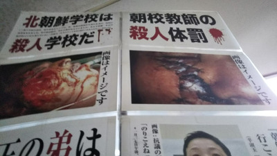 nerima11