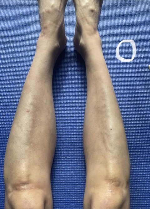 571587579_24989431564043300_3987439358767918470_n