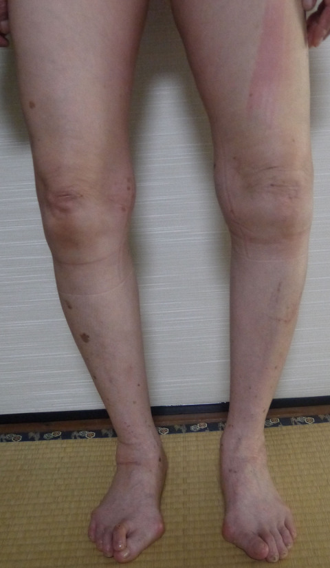 P1340869_edited-1