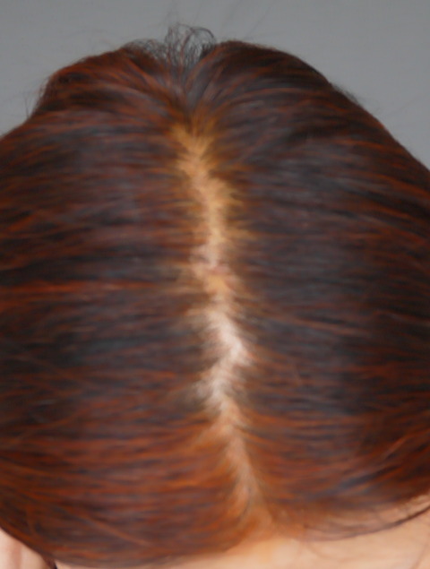 P1400713