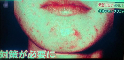 97997168_2974354885977617_3572690209269088256_n