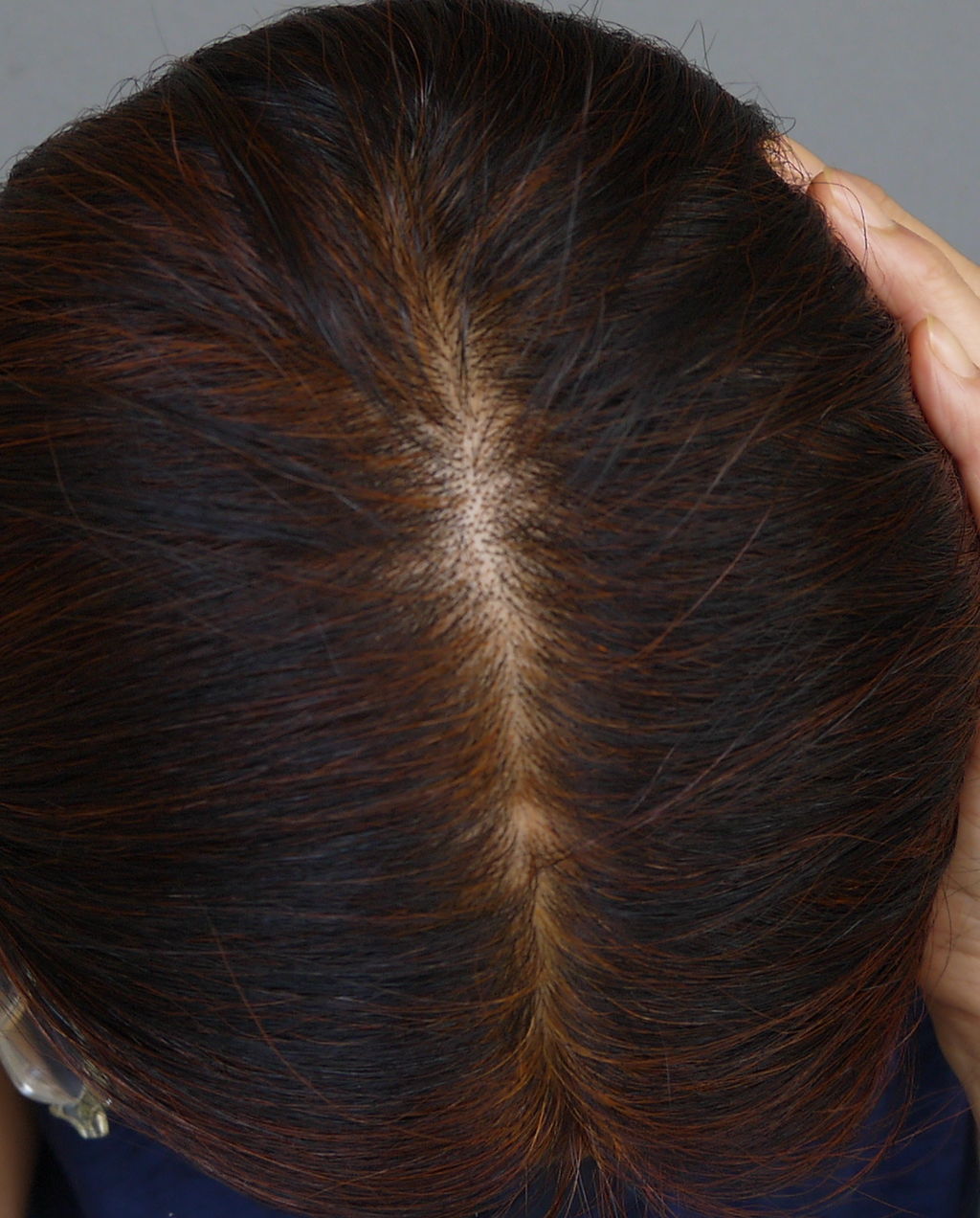 お家ヘナ ハイビスカスパワーにびっくり Keiko Kubo