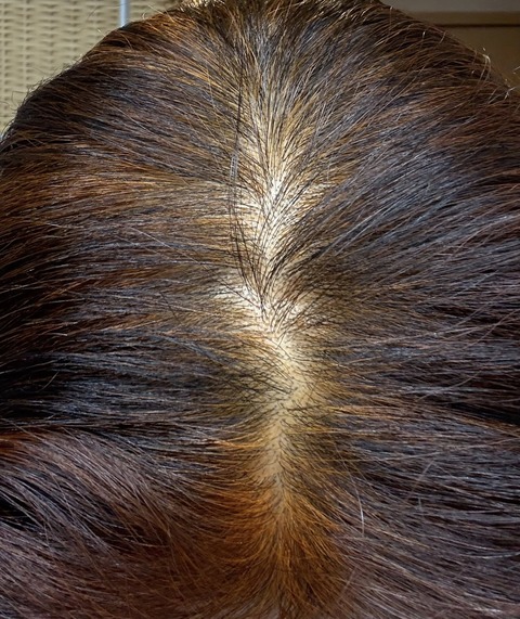 607566031_25537946142525170_8239658265316211436_n