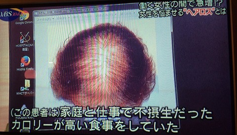 37734254_1809997302413387_5156855490143059968_n