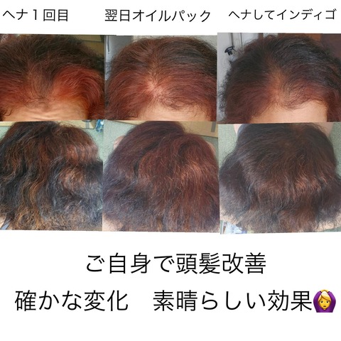 534666314_24391657053820757_7784166510491652098_n