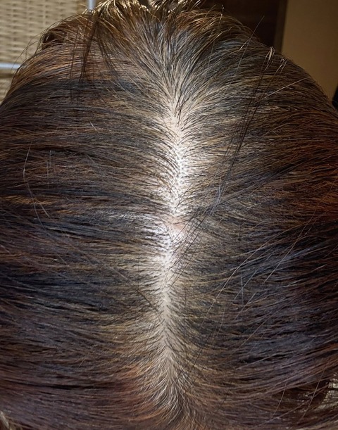 605120730_25516963731290078_3569130049653340180_n