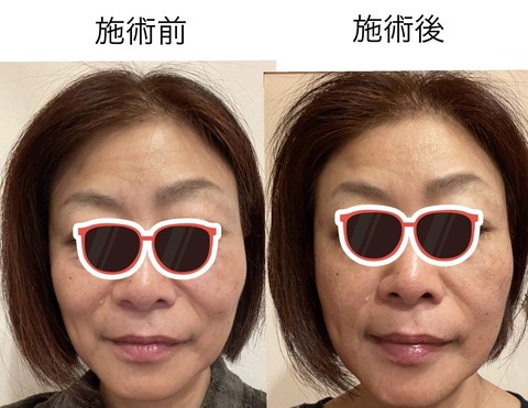 585888680_25247786111541176_7117291576805224542_n