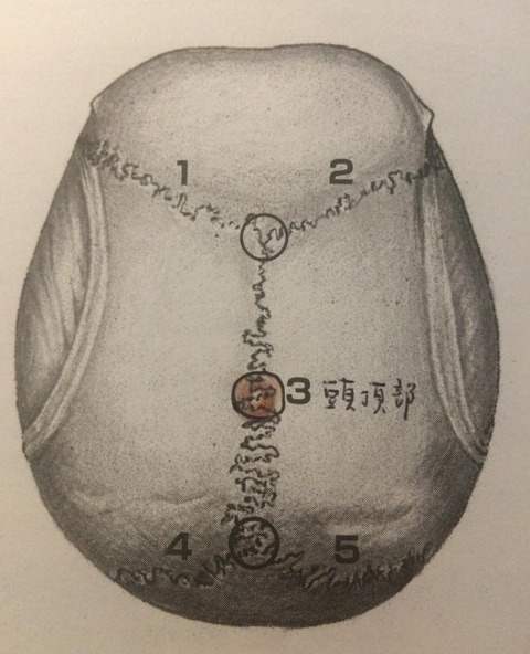 34307614_1736914159721702_1149918330329497600_n