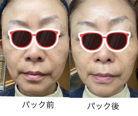 584636889_25196784379974683_1247283101652152017_n