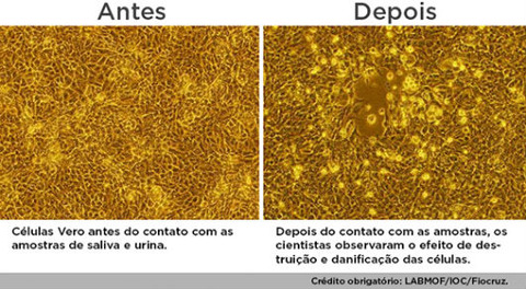 celulas_antes_depois_zika_interna