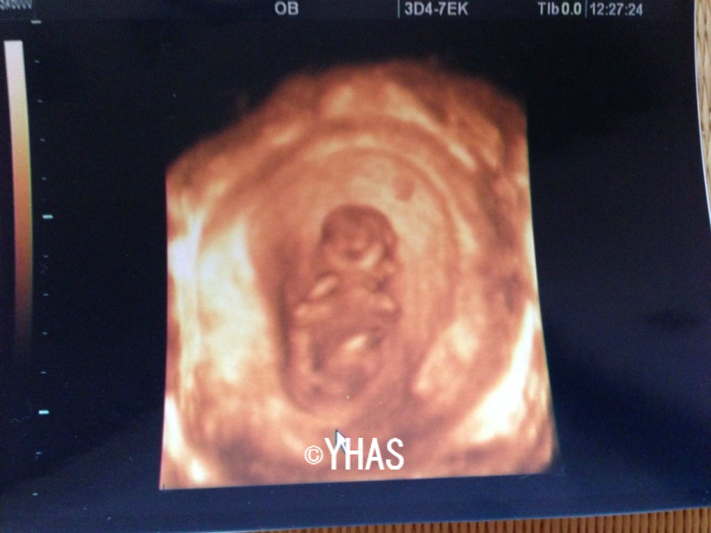 12w1d 2回目の妊婦健診 妊娠4ヵ月 妊活からの育児blog