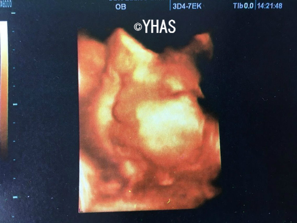 妊活からの育児blog 妊活からの育児blog