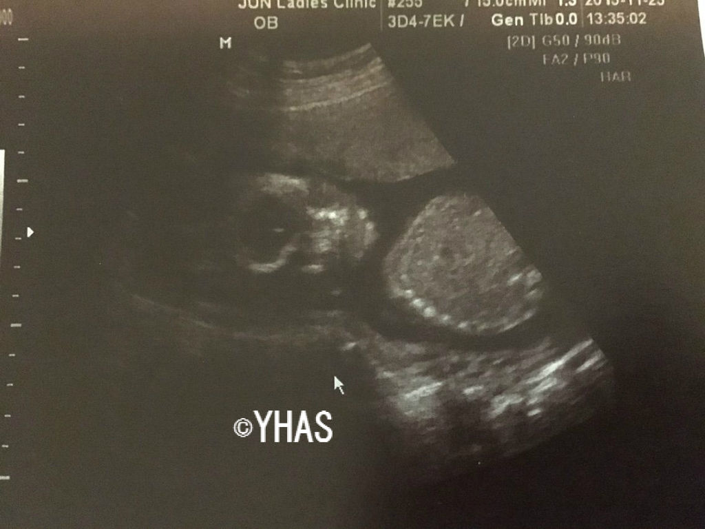 w1d 4回目の妊婦健診 性別判明 妊娠6ヵ月 妊活からの育児blog w1d 4回目の妊婦健診 性別判明 妊娠6ヵ月 妊活からの育児blog
