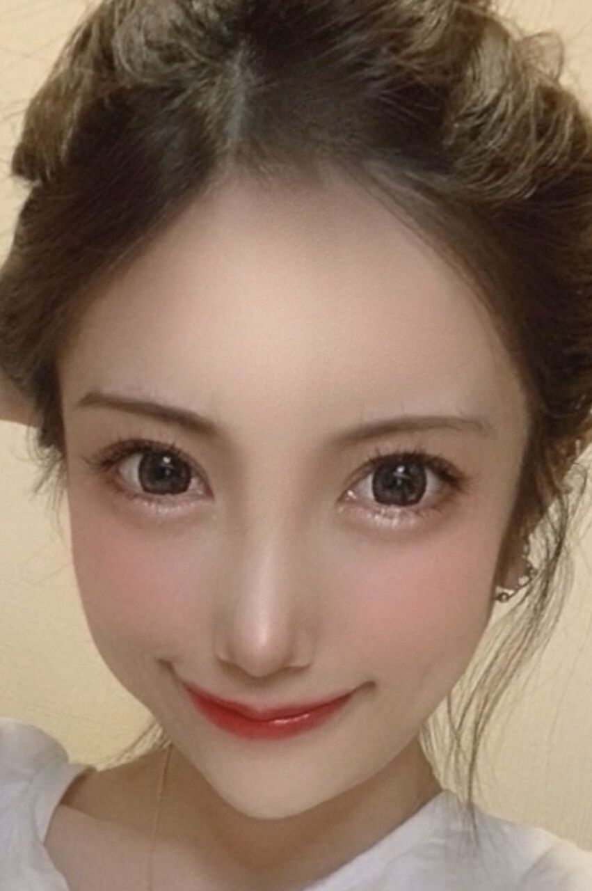 悲報 まんさん 整形失敗してお岩さんみたいになってしまう スパロボニュース 悲報 まんさん 整形失敗してお岩さんみたいになってしまう スパロボニュース