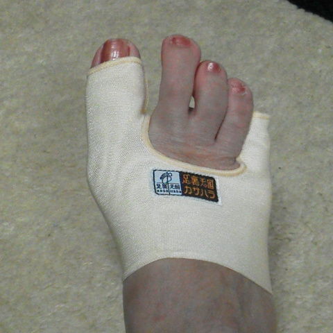 外反母趾 サタママのたわごと