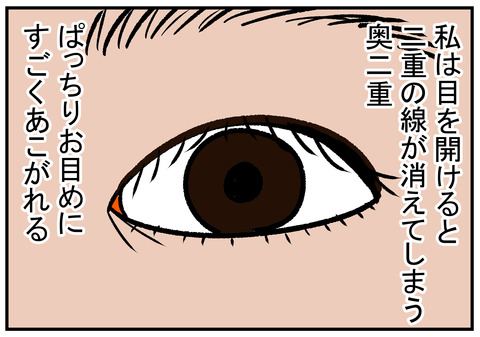 H31.3.18　念願の二重　1