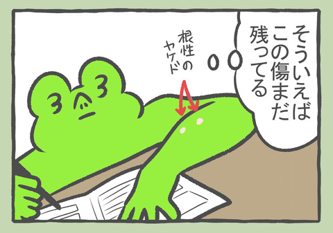 R4.11.17 4