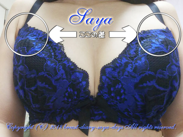 利き手の影響 ブラにお肉を詰めた時に左右差がでちゃいます C65からh65に アラサー27歳からの育乳バストアップ記録