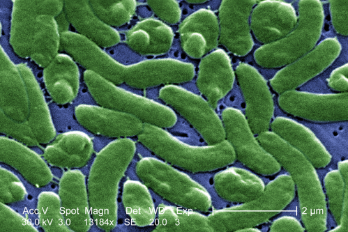 Vibrio_vulnificus_01