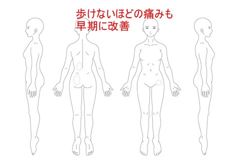 歩けないほどの痛みも早期に改善