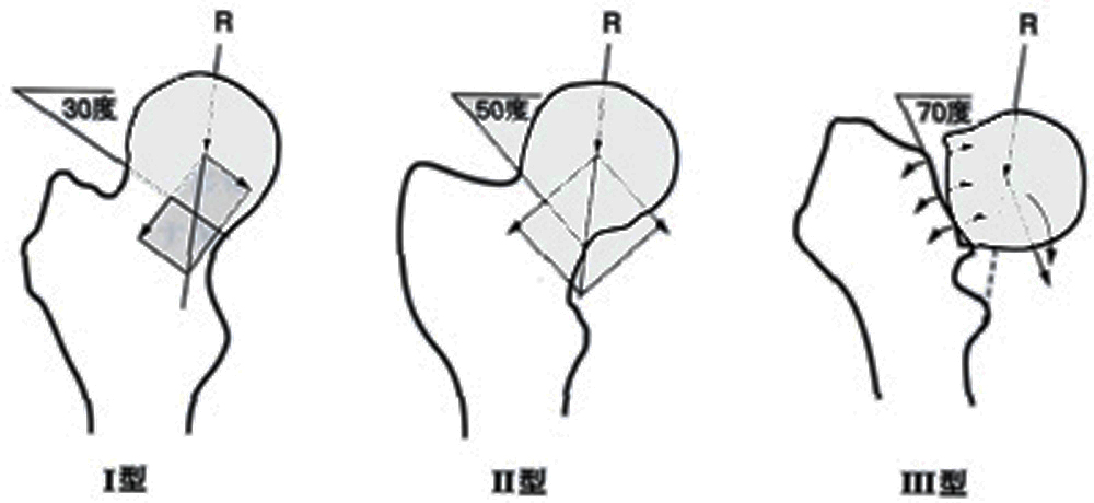 整骨太郎のひとりごと