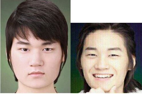 韓国人 イケメンに成る方法 整形手術で人生大逆転 不細工が超イケメンに成ったビフォア アフター画像をご覧ください 世界の憂鬱 海外 韓国の反応
