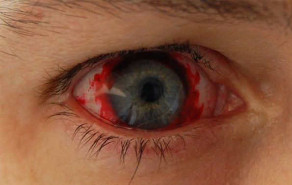 海外 物凄く怖いコンタクトレンズのデザインが海外のサイトで話題に 腐女速