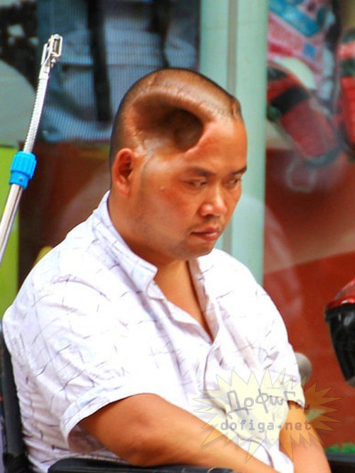 【閲覧注意】 大怪我を負い頭に「巨大な穴」が開いてしまった中国人男性が余りにもヤバ過ぎるだろ・・とロシアのサイトで