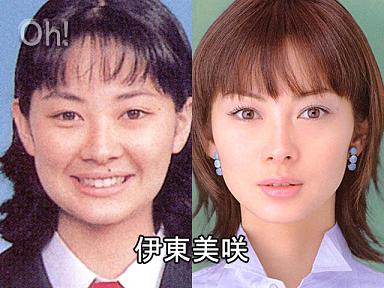 整形と芸能人 整形している芸能人について 整形と芸能人 整形している芸能人について