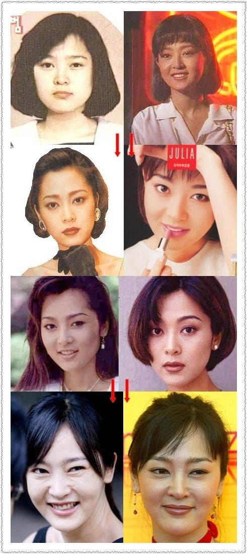 韓国芸能人の整形前後 Soratopapa S Diary 韓国芸能人の整形前後 Soratopapa S Diary