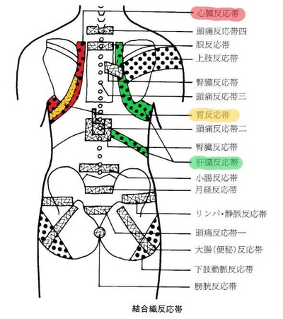 結合織反応帯