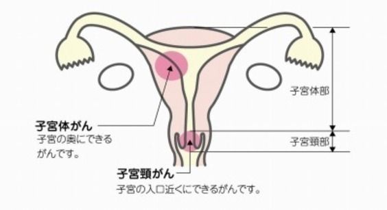 処女は子宮がん検診を受ける必要がない 検診という名の鉄のレイプ 日本にかける虹