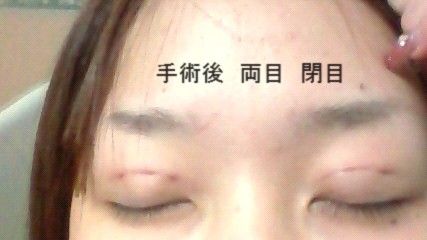 整形ブログ 整形ブログ