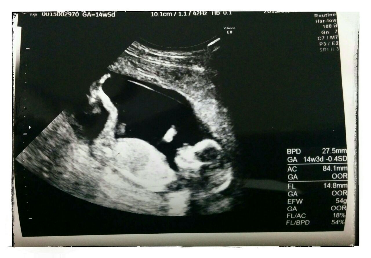 妊婦検診2回目 エコー写真 はじめての妊娠 子育て