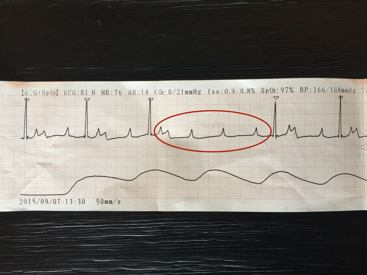 犬の不整脈を発見 手術の麻酔について 柴犬ハッピーのしつけ 子犬の悩み110番