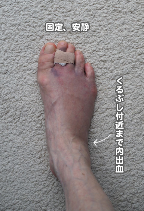 18日朝ブログ２