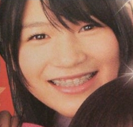 画像 あまちゃん 能年玲奈 間違いなく整形か ニコラ時代とあまりにも顔が違うとネットで話題 柴犬24時 画像 あまちゃん 能年玲奈 間違いなく整形か ニコラ時代とあまりにも顔が違うとネットで話題 柴犬24時