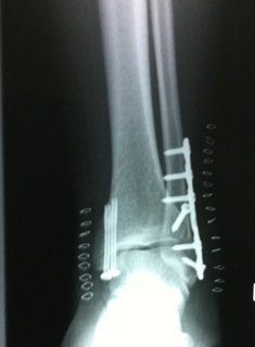 photo1
