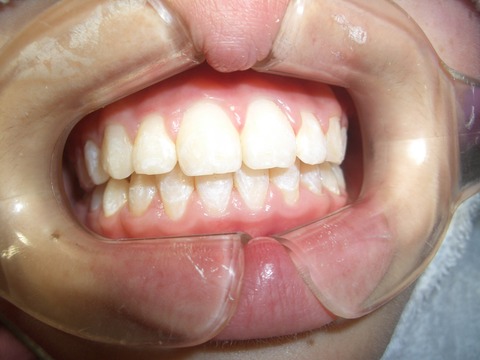 CIMG0175 - コピー